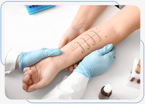 Allergies at Internists of North Dallas Located in Irving, TX Allergies at Internists of North Dallas Located in Irving, TX